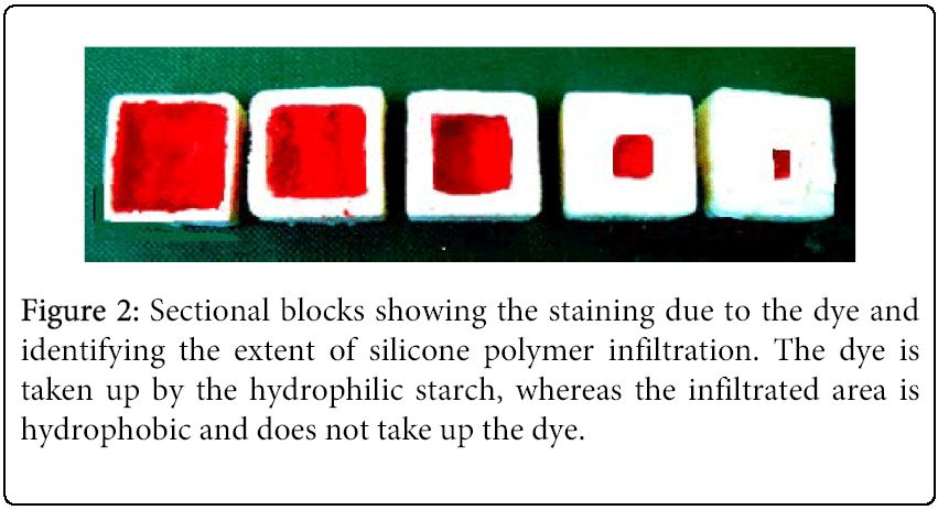 anaplastology-sectional-blocks
